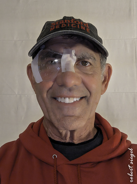 cataract surgery March 2 2026